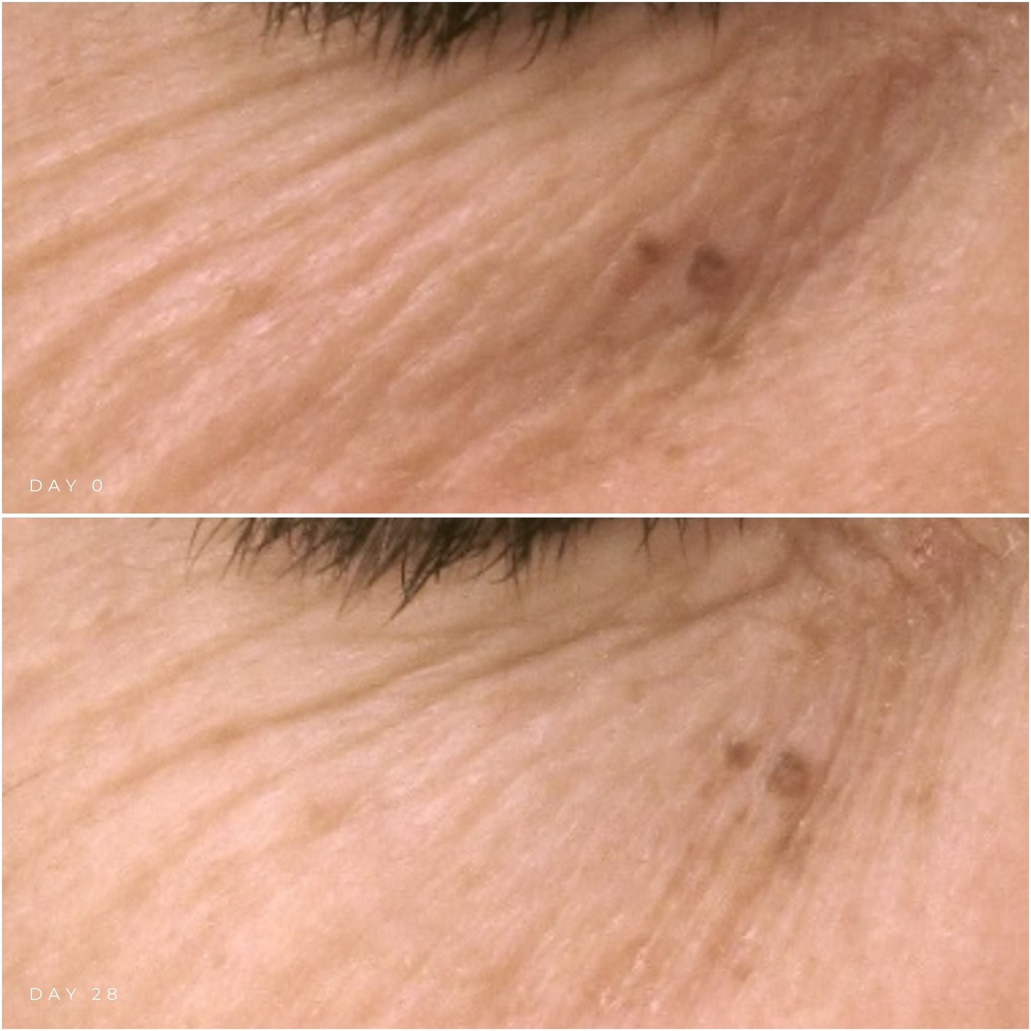 GM Collin Hyaluronic Filler Eye Contour