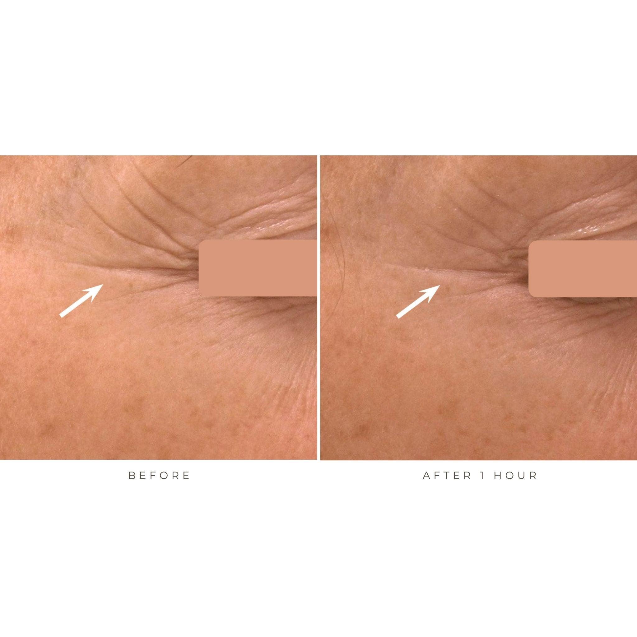 GM Collin Hyaluronic Filler Serum - The Beauty House Shop